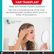 Hair Transplant Dubai Clinic