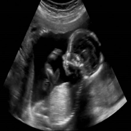 Feto Maternal & GenetYX Center