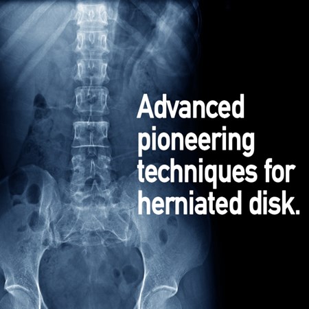 Spinal Treatments & Surgery in Dubai